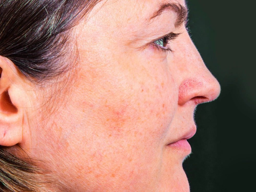 image comparison before
