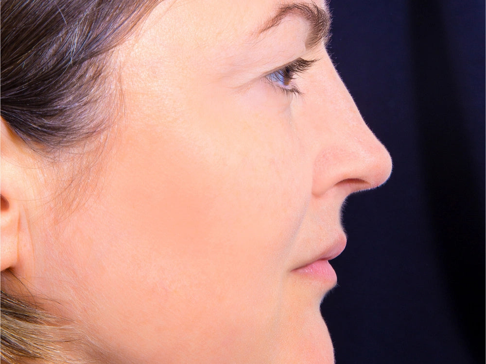 image comparison after