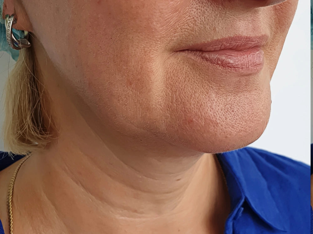 image comparison before