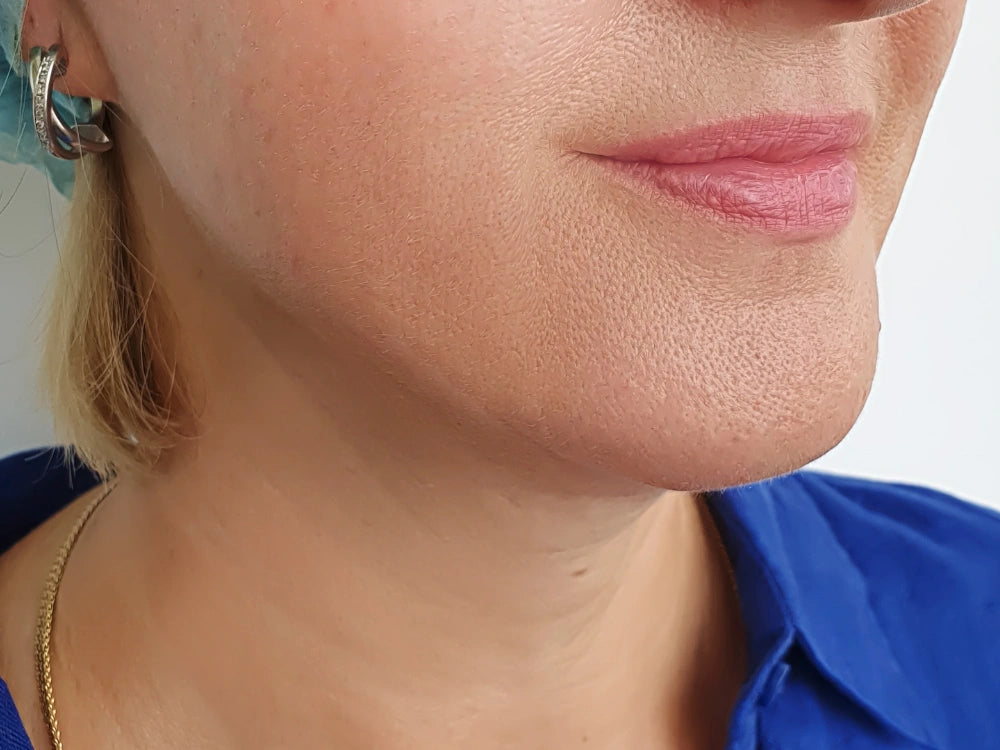 image comparison after