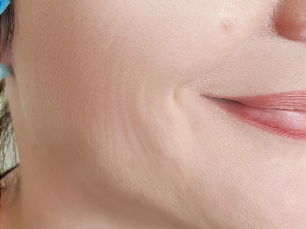 Retinol_Oil_Results