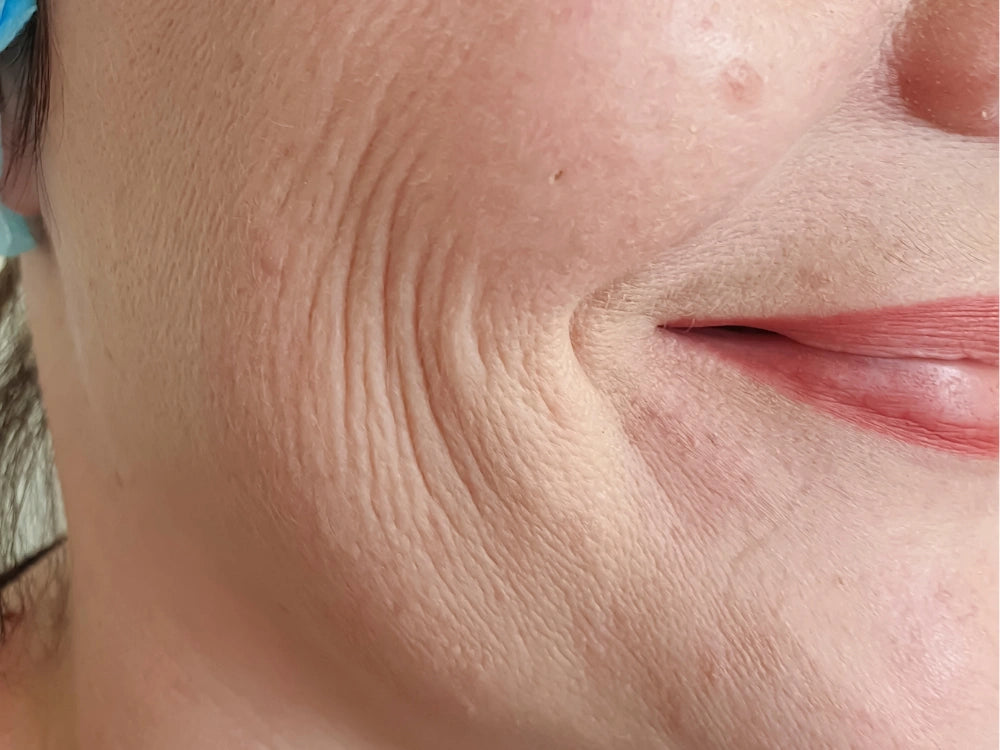 Retinol_Oil_Serum_Results